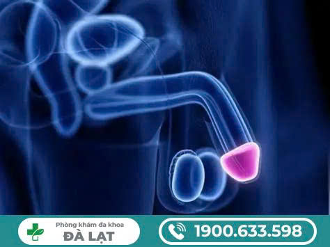 Hình ảnh minh họa